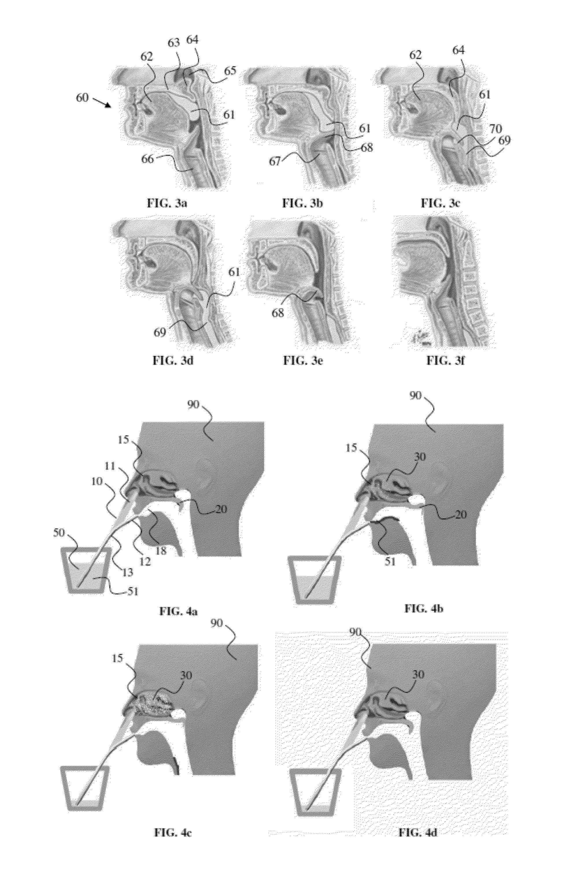 Nasal delivary device