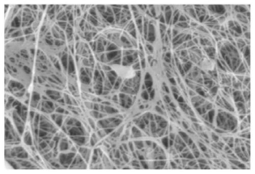 Collagen/bacterial cellulose composite membrane dressing and preparation method thereof