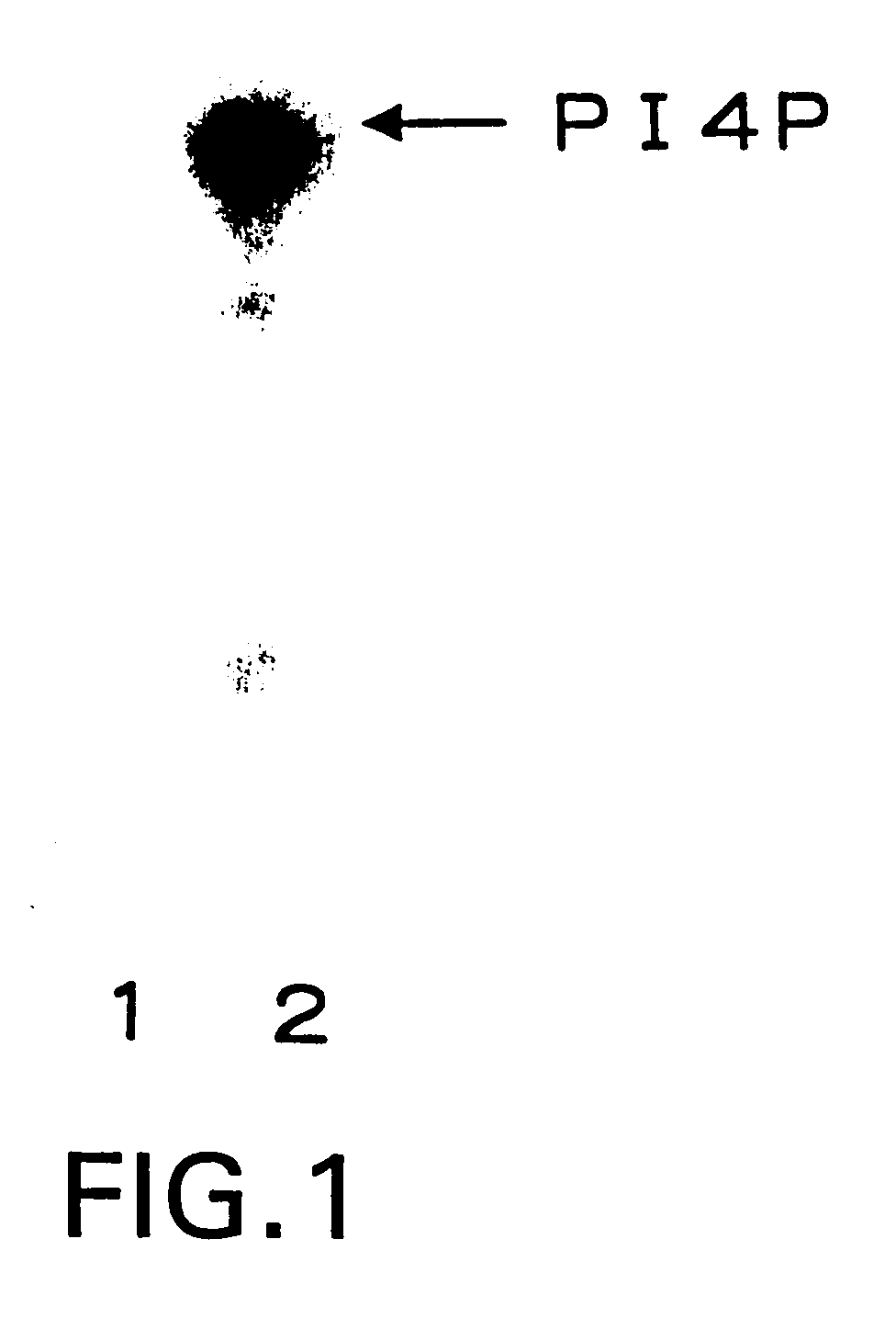 Method for detecting expression of human skeletal muscle-specific unbiquitin-conjugated enzyme