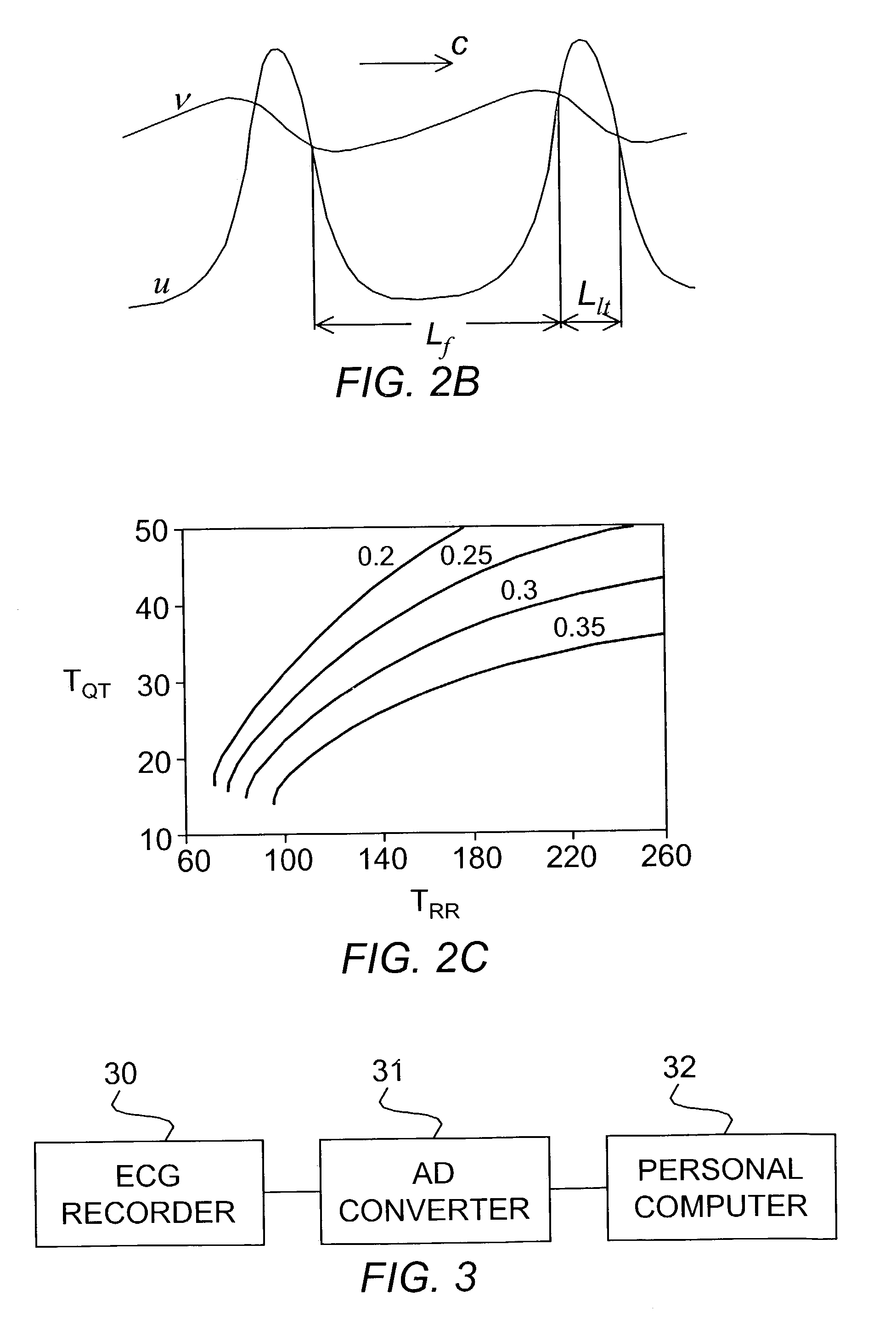 Method and system for evaluating cardiac ischemia with an exercise protocol