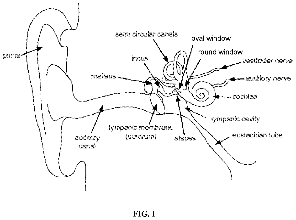 Otic formulations for drug-induced ototoxicity