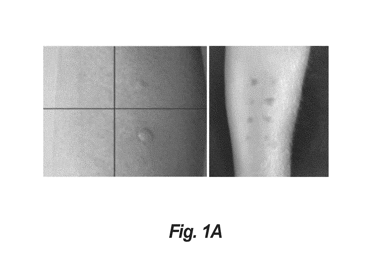 Systems and methods for image-based quantification for allergen skin reaction