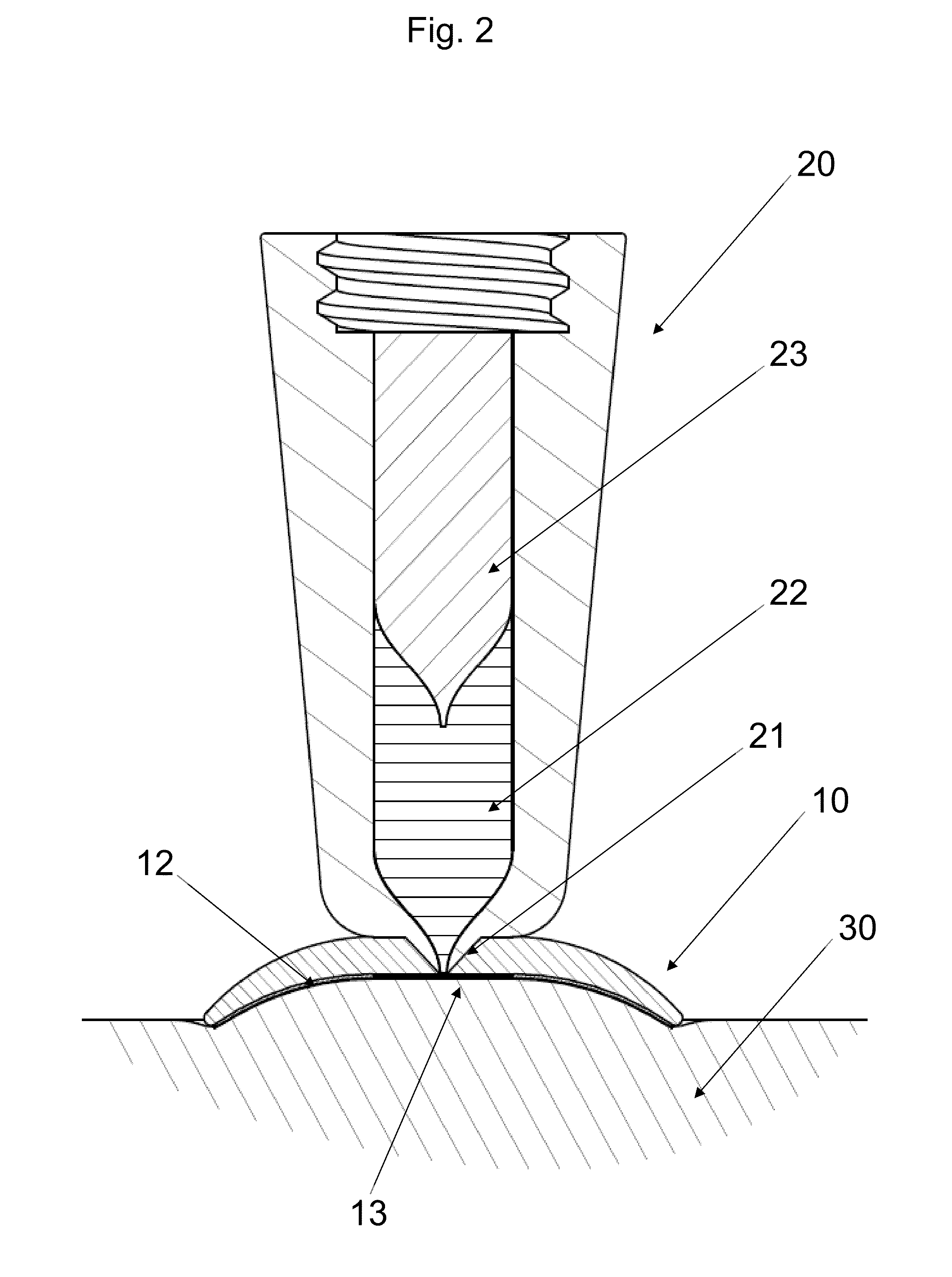 Skin Retention Device for a Medical Jet Injection Kit