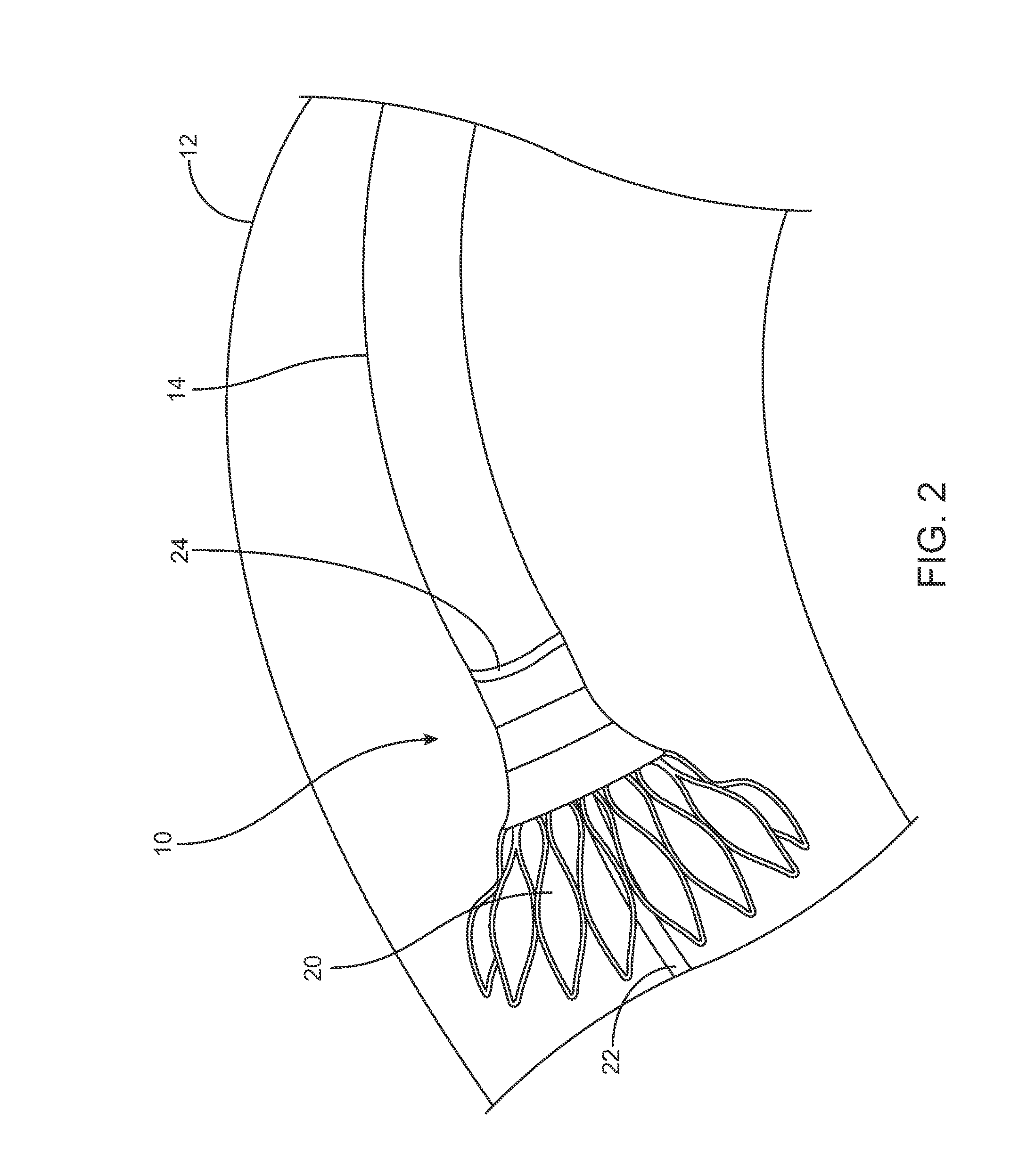 Medical device delivery systems and methods of use thereof