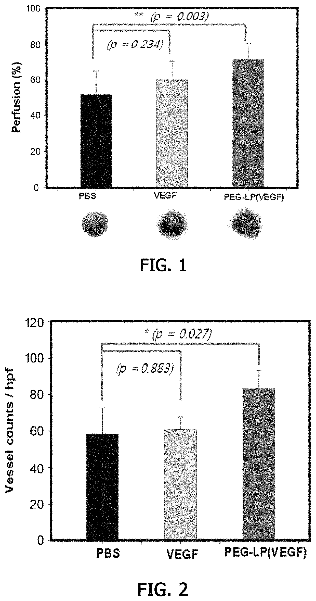 Composition for preventing or treating ischemic diseases, containing liposomes in which VEGF-derived peptides are supported