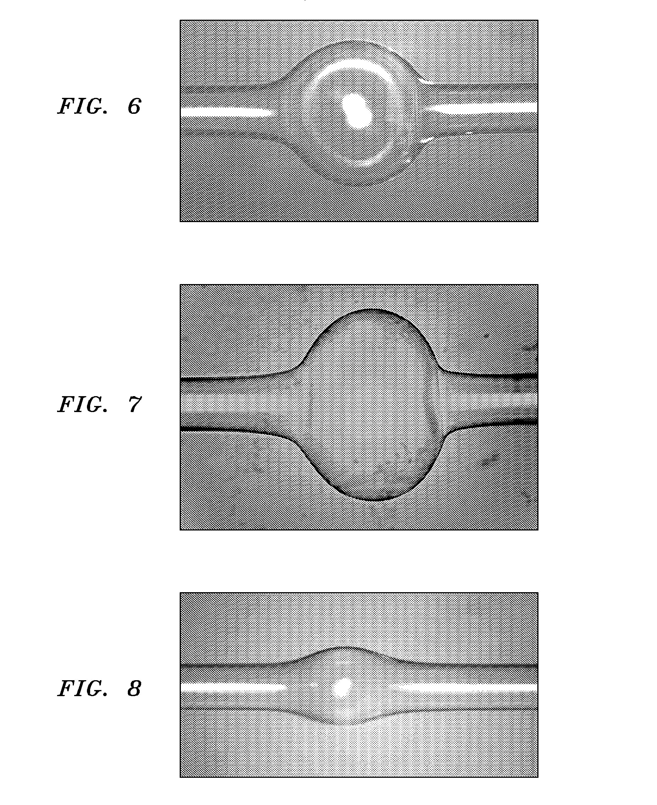 Microbubble optical resonator