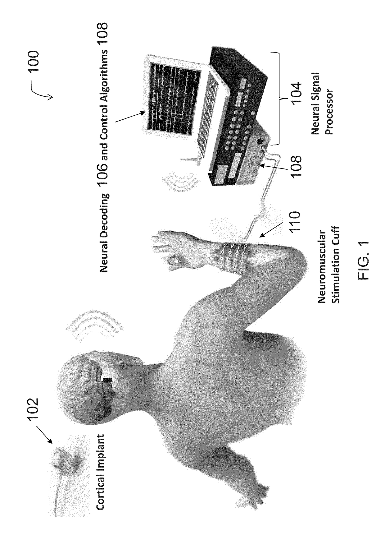 Neural sleeve for neuromuscular stimulation, sensing and recording