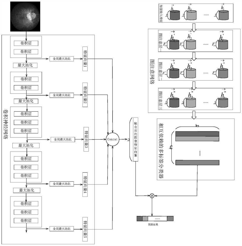 Multi-label eye fundus image recognition method based on GACNN