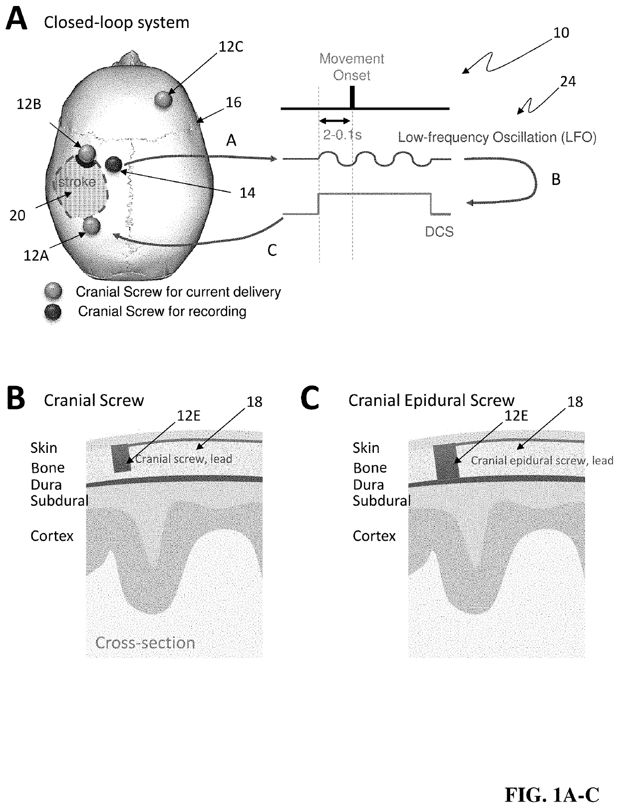 Systems methods and devices for closed loop stimulation to enhance stroke recovery