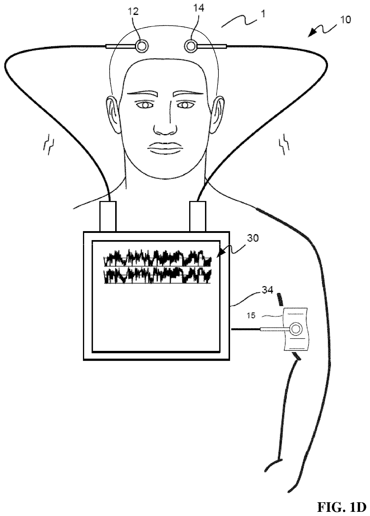 Systems methods and devices for closed loop stimulation to enhance stroke recovery