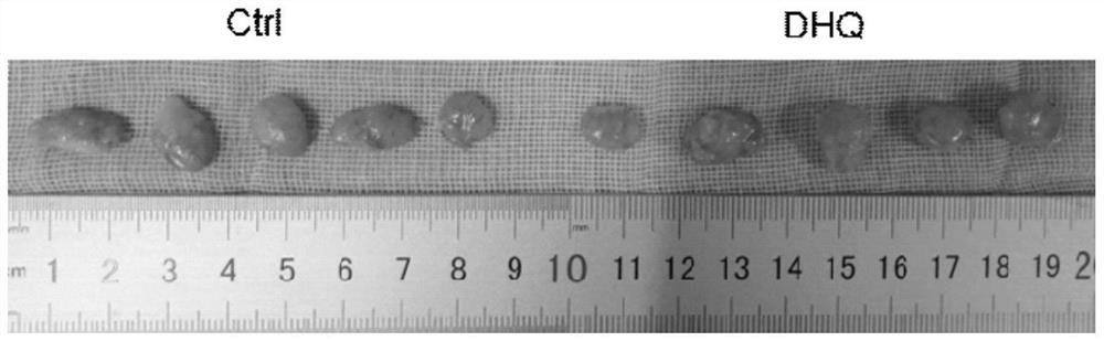 Application of toxifolin in treating or preventing fat liquefaction and necrosis after lipofilling