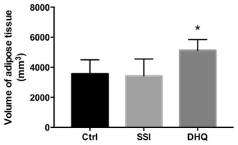 Application of toxifolin in treating or preventing fat liquefaction and necrosis after lipofilling