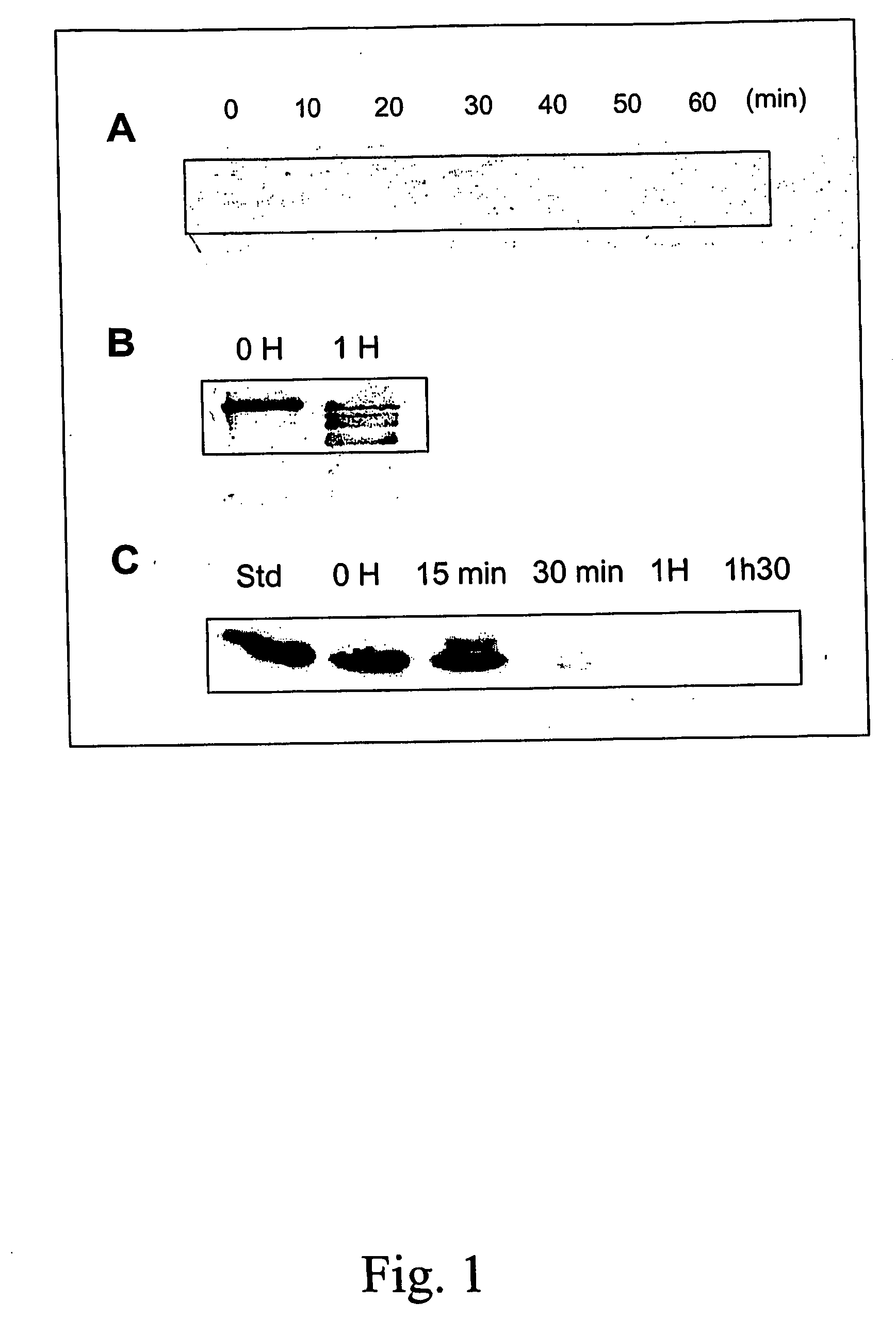 Method for enhancing yield of recombinant protein production from plants