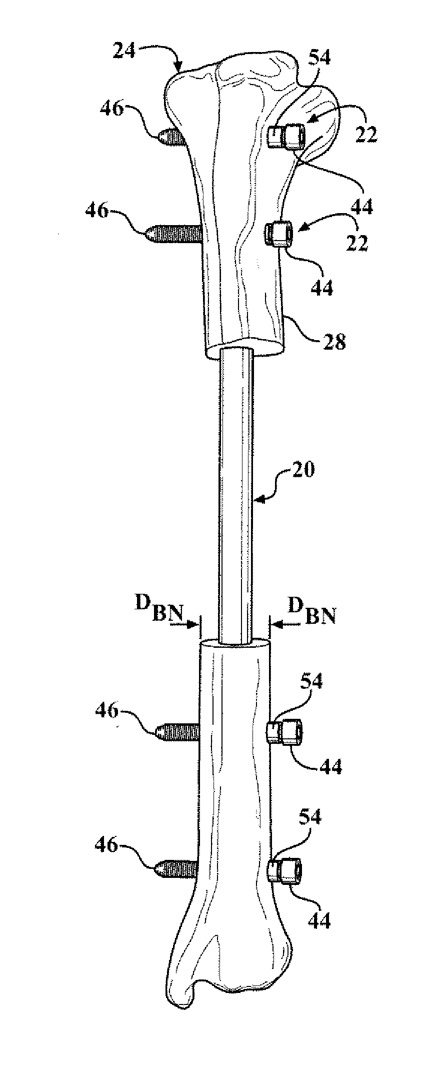 Easily implantable and stable nail-fastener for skeletal fixation and method