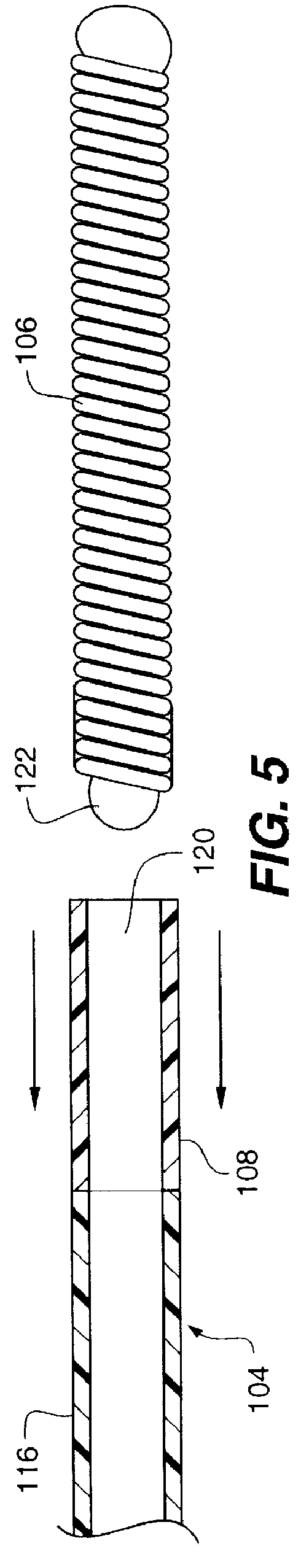 Embolic coil hydraulic deployment system