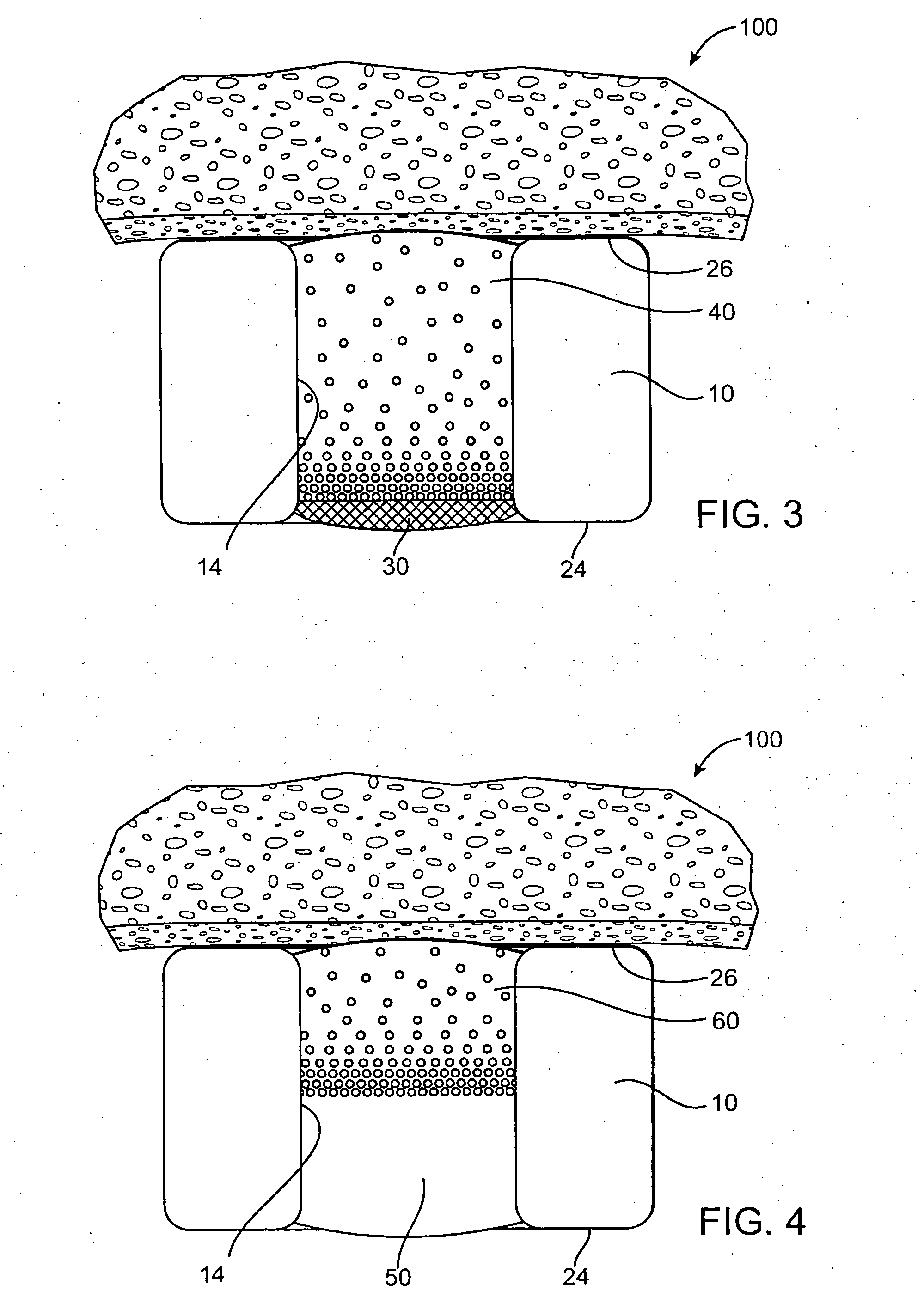 Methods of delivering anti-restenotic agents from a stent