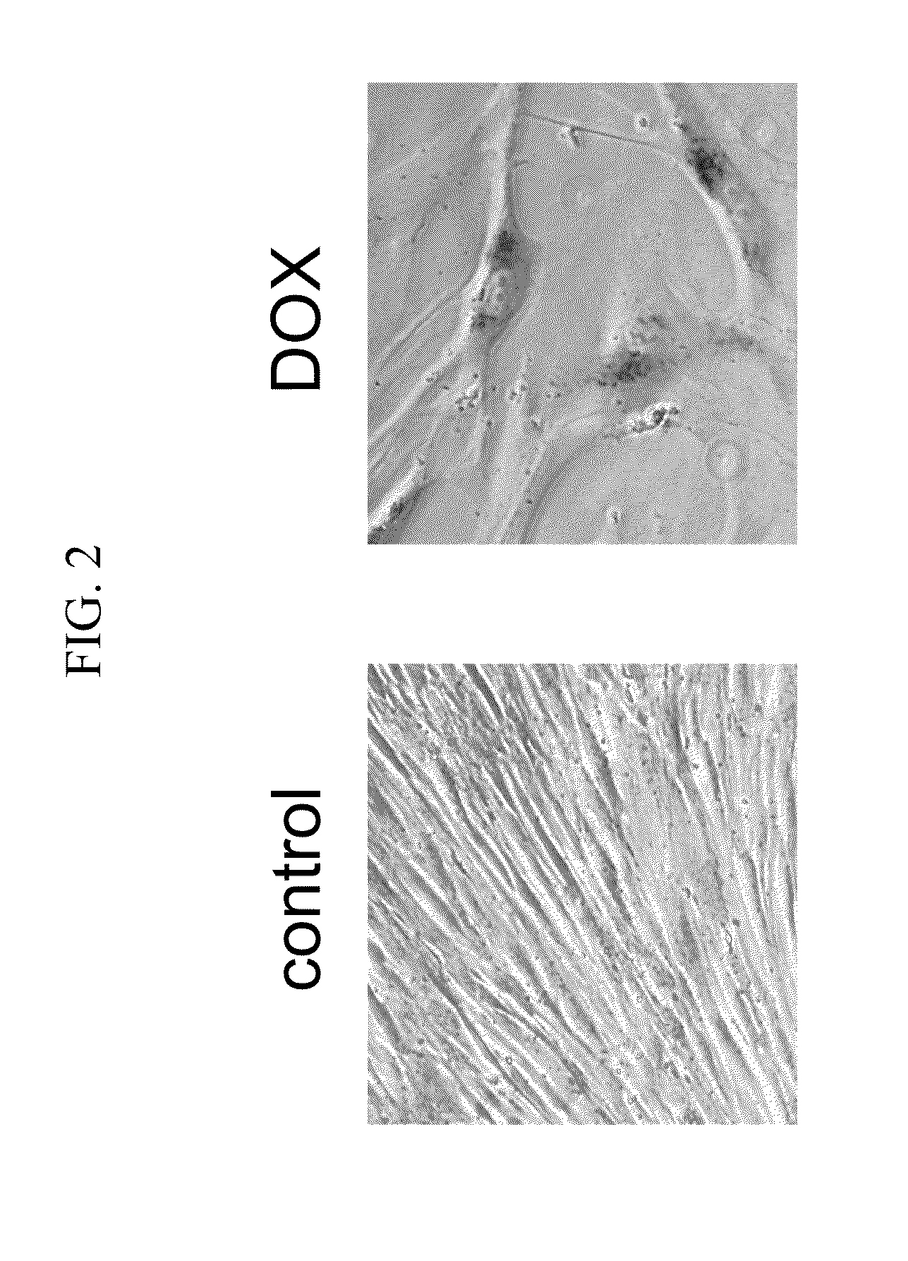 Methods and Compositions for Preventing or Treating Age-Related Diseases