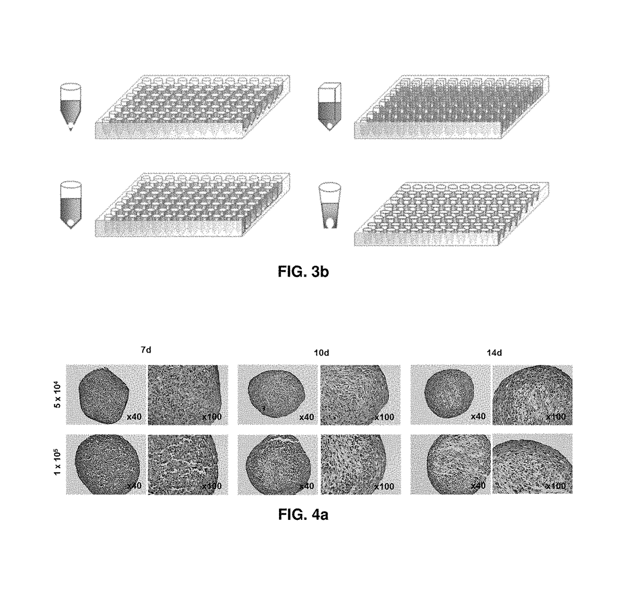Preparation method for therapeutic agent of bead-type chondrocyte