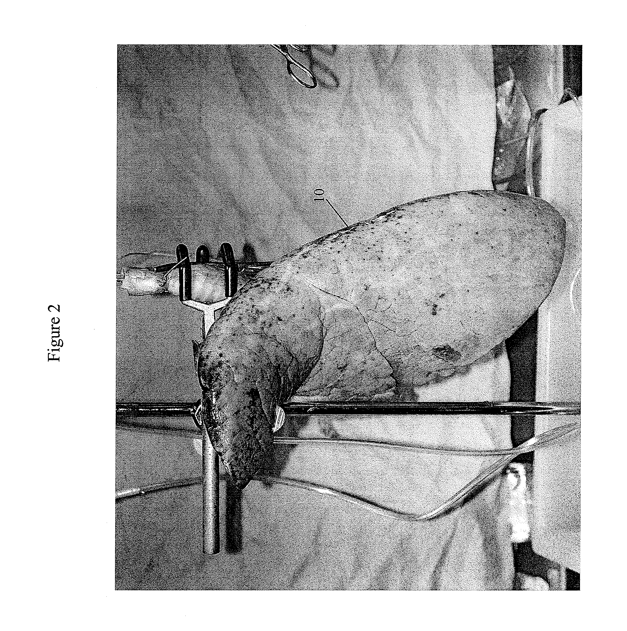 System and method for detection and repair of pulmonary air leaks