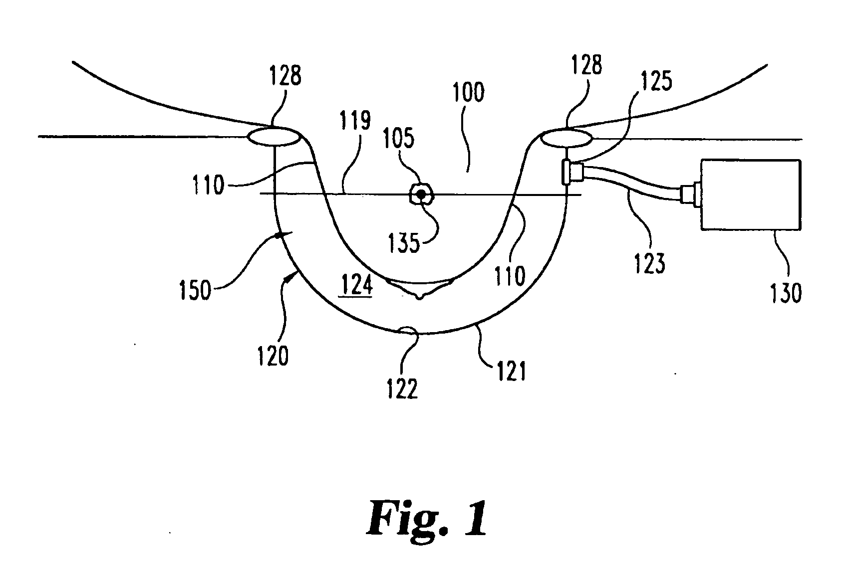Apparatus and method for the treatment of breast cancer with particle beams