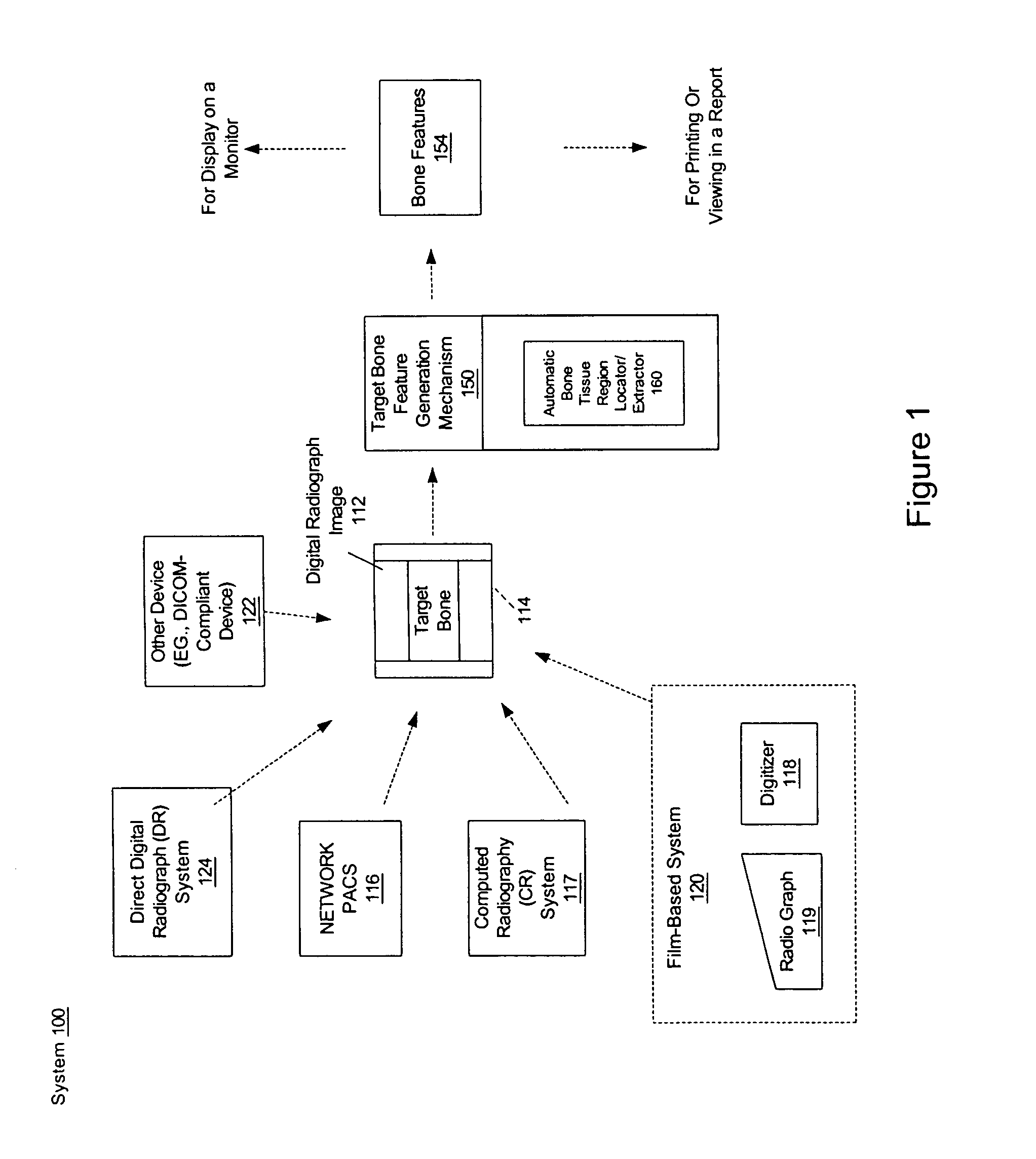 Method and system for automatically identifying regions of trabecular bone tissue and cortical bone tissue of a target bone from a digital radiograph image