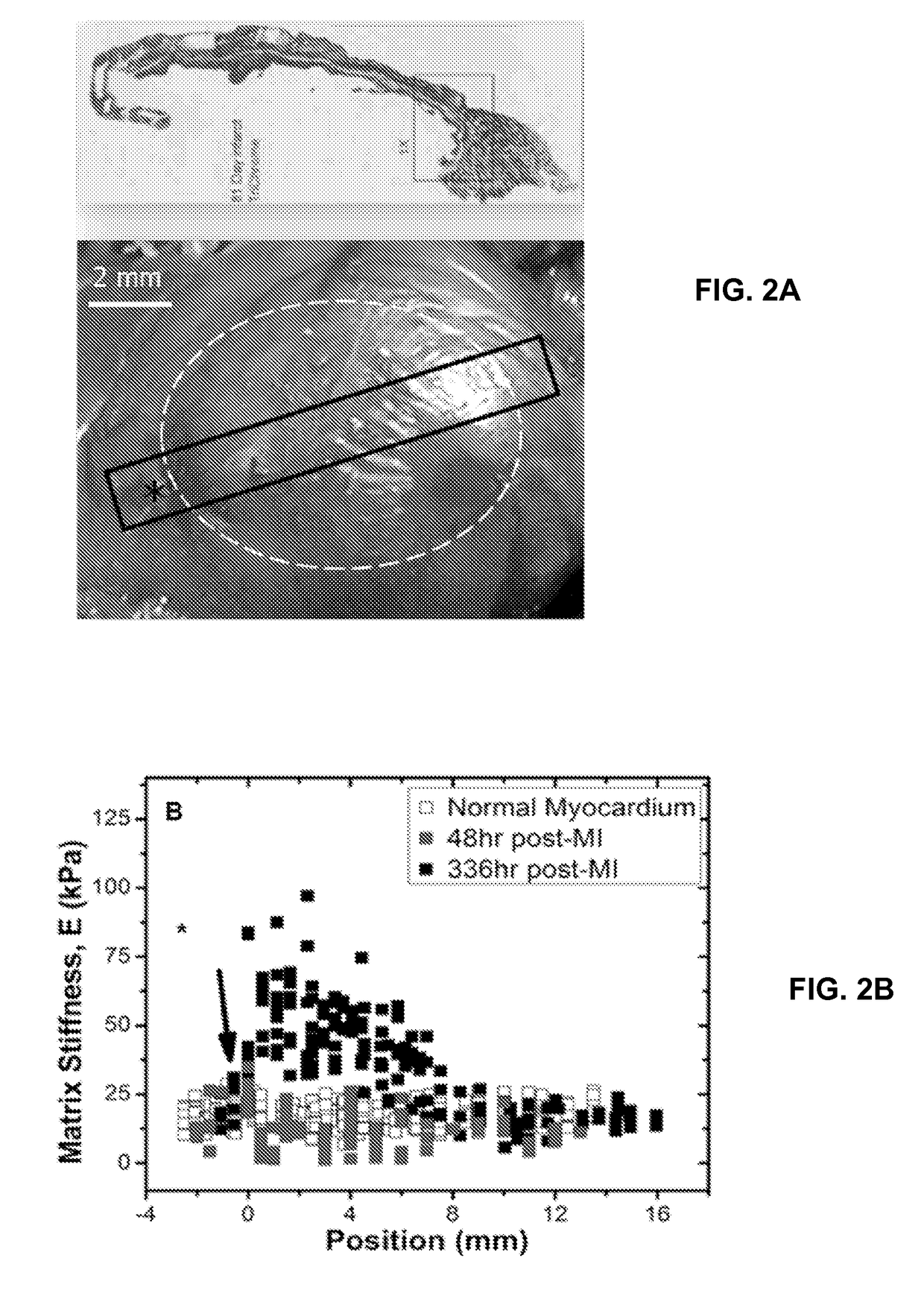 Systems and methods of disease modeling using static and time-dependent hydrogels