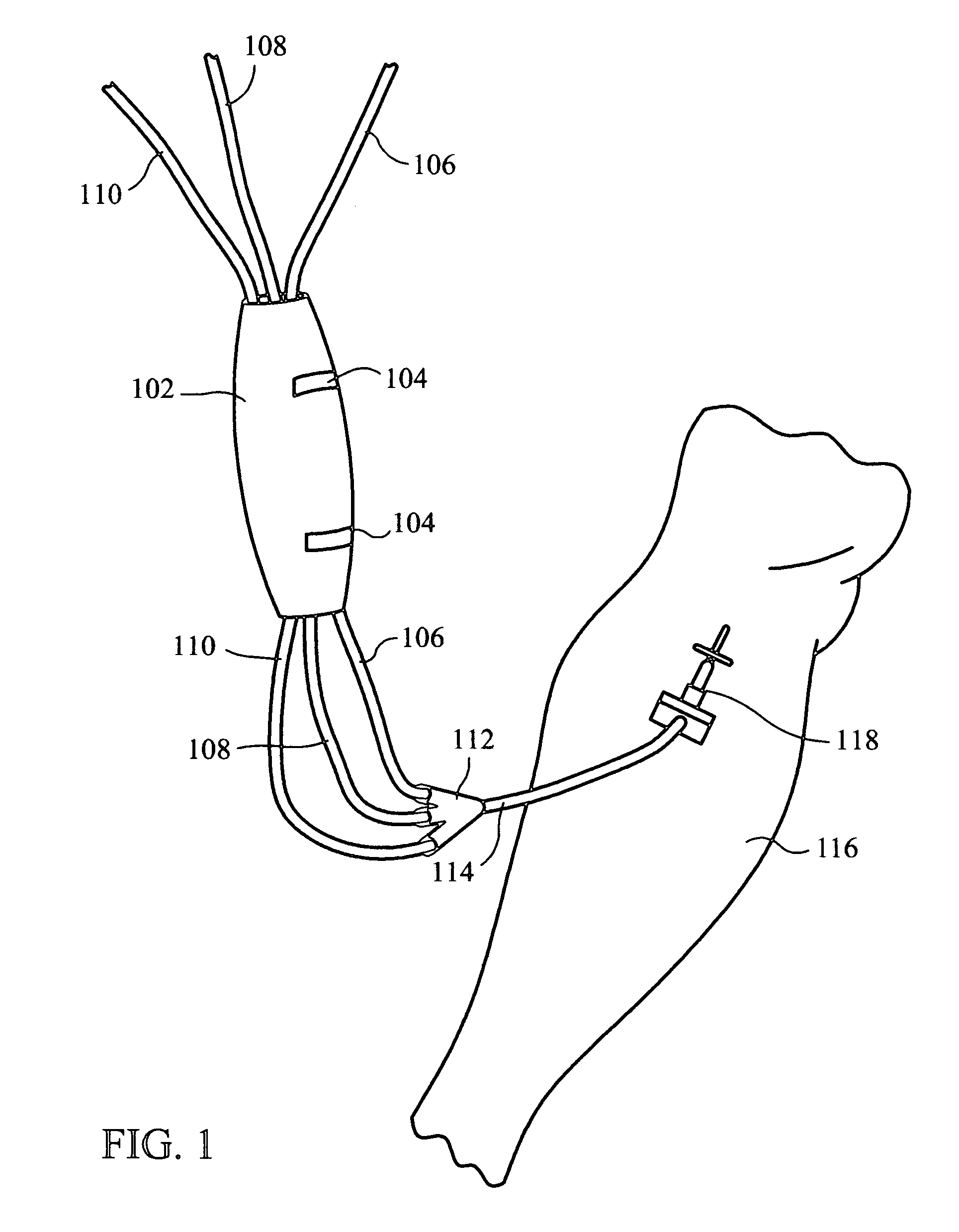 Intravenous tubing protector and support system