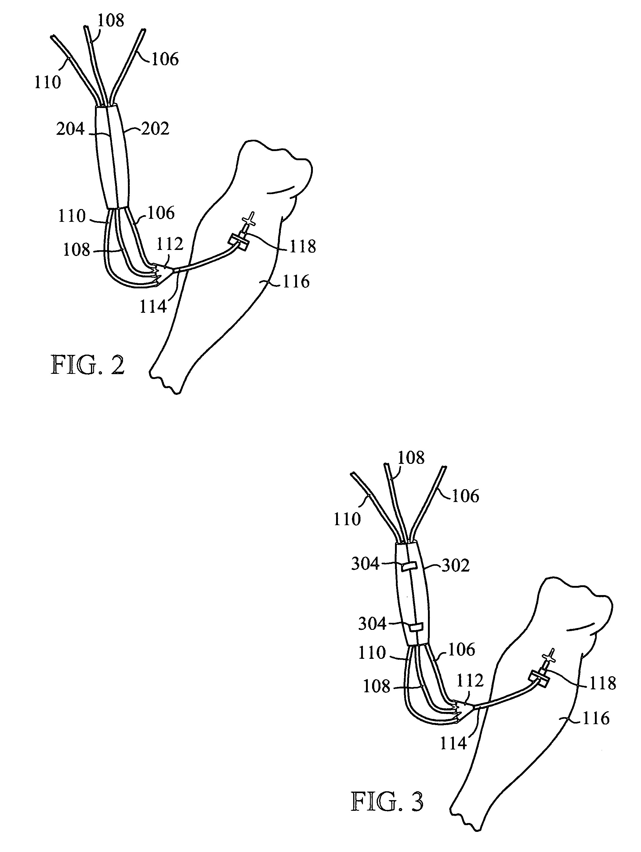 Intravenous tubing protector and support system