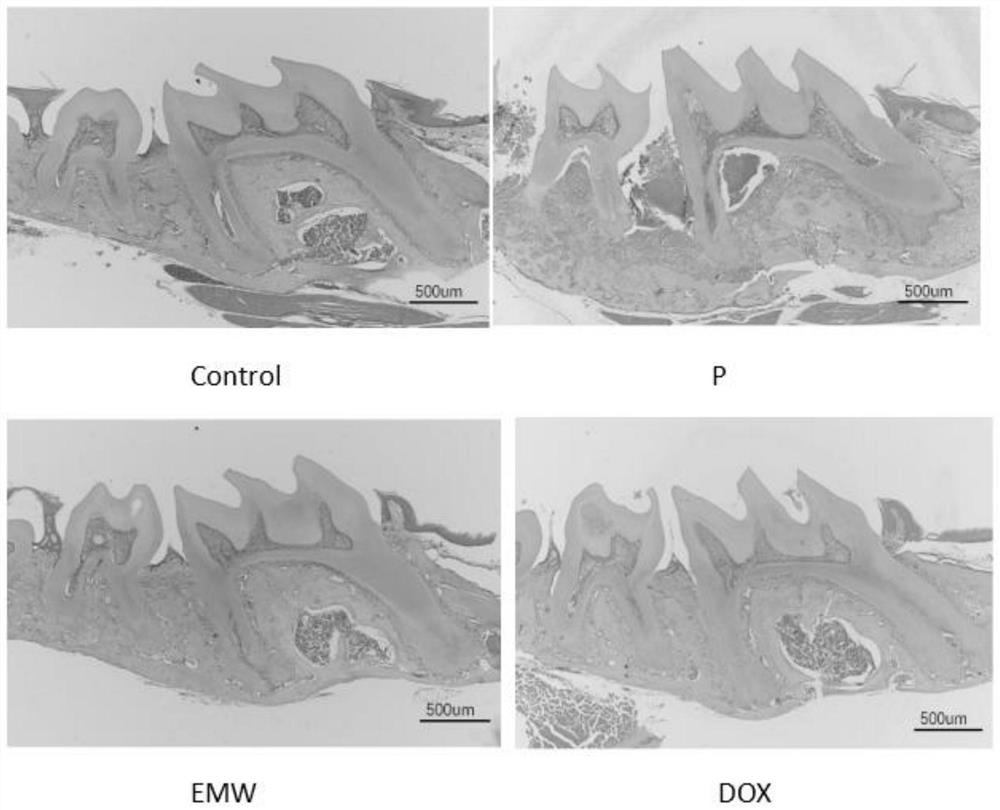 Application of Ermiao pill in preparation of medicine for treating or preventing periodontitis