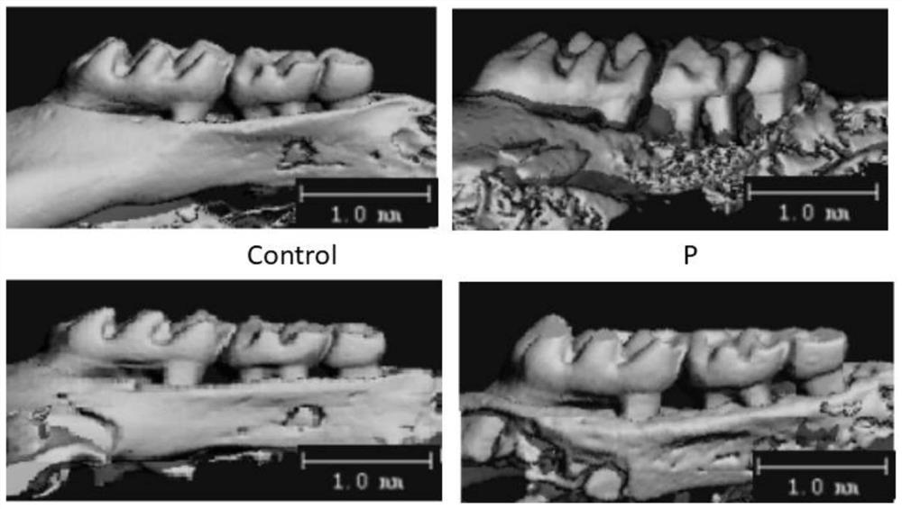 Application of Ermiao pill in preparation of medicine for treating or preventing periodontitis