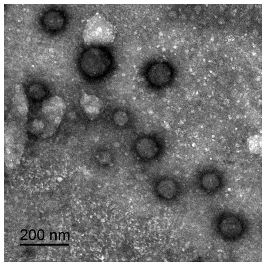 A kind of preparation method of chitosan quaternary ammonium salt-fatty acid vesicle