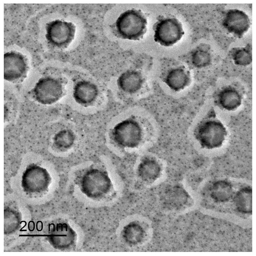 A kind of preparation method of chitosan quaternary ammonium salt-fatty acid vesicle