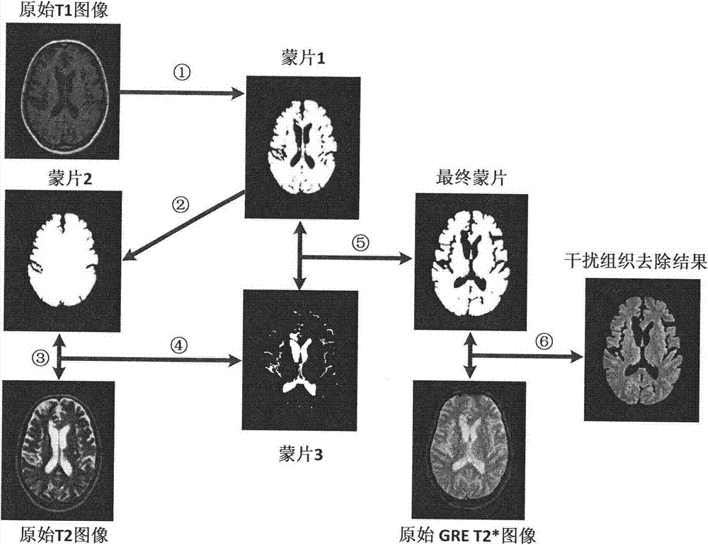 Computer-aided detection system for cerebral microbleeds based on magnetic resonance images