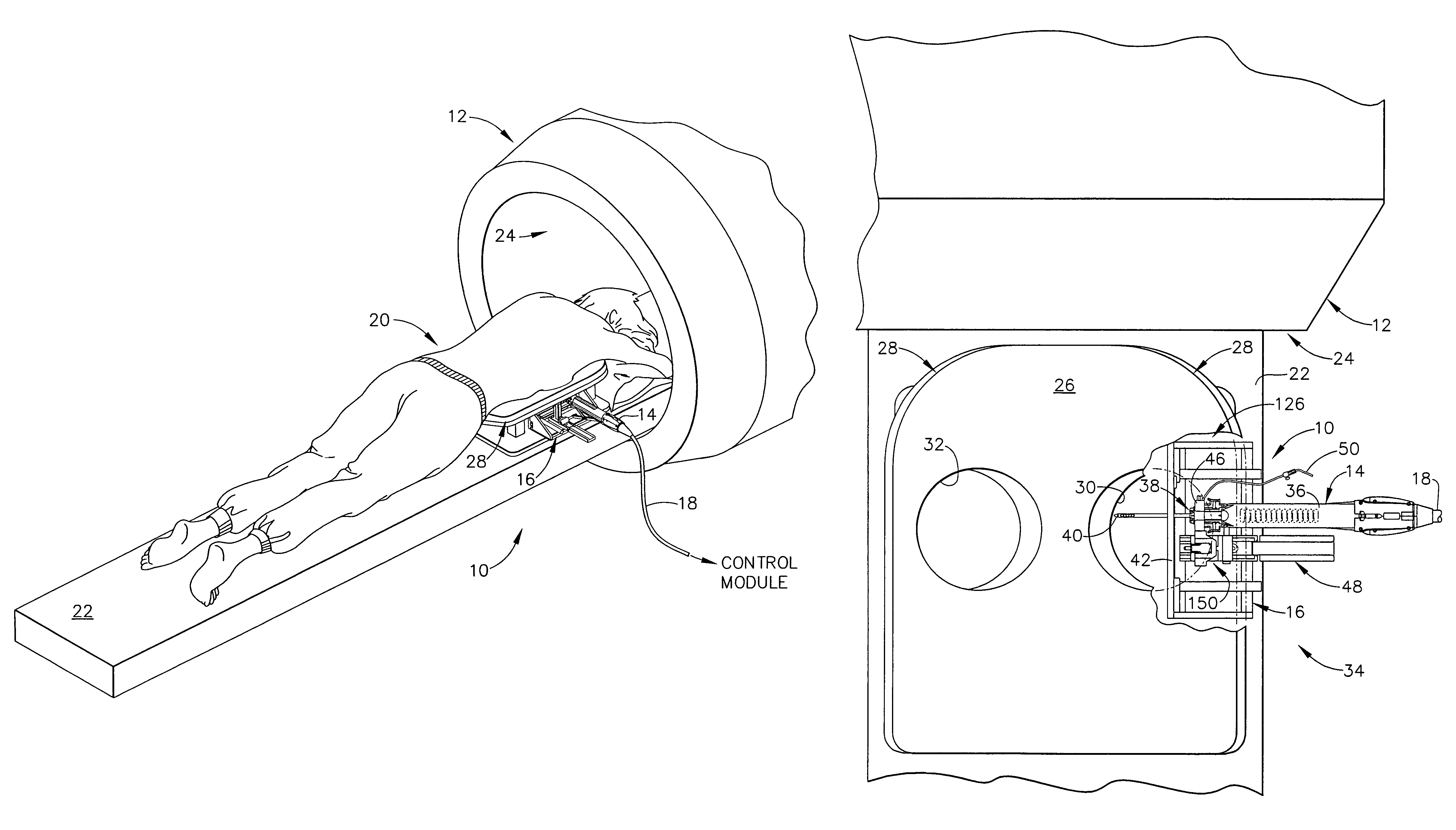 Method for using an MRI compatible biopsy device with detachable probe