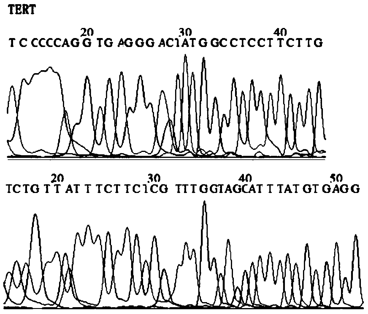 Primer probe group, kit and detection method for detecting fusobacterium nucleatum in saliva