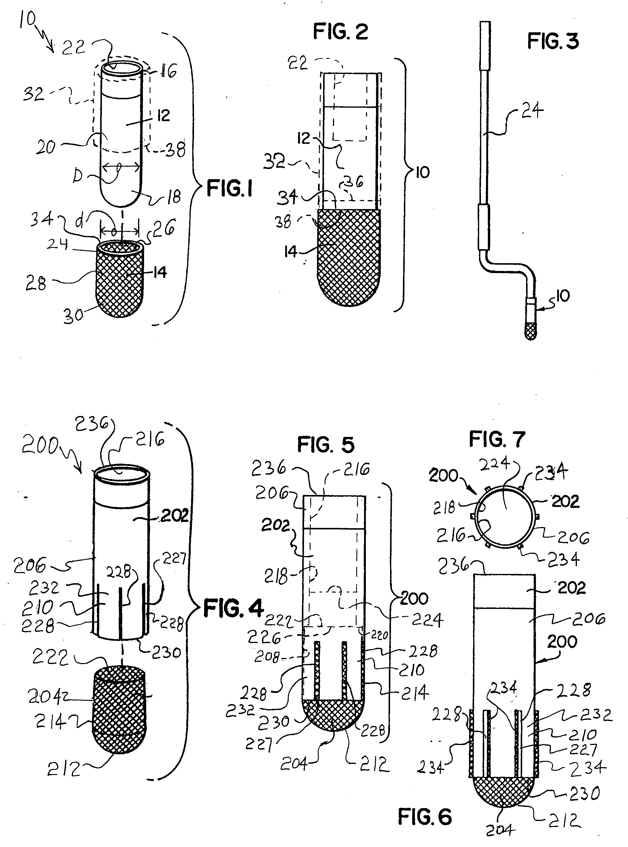 Expandable bone implant