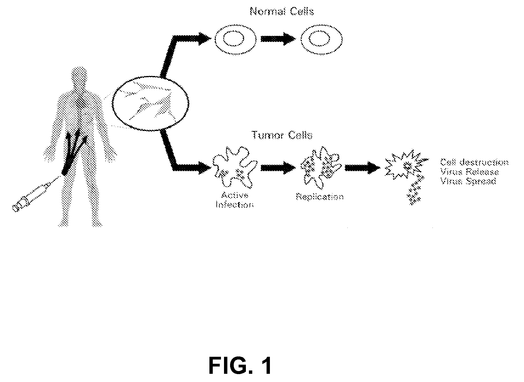 Seneca valley virus based compositions and methods for treating disease