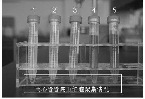Anti-coagulation anti-bacterial biomedical material and preparation method thereof