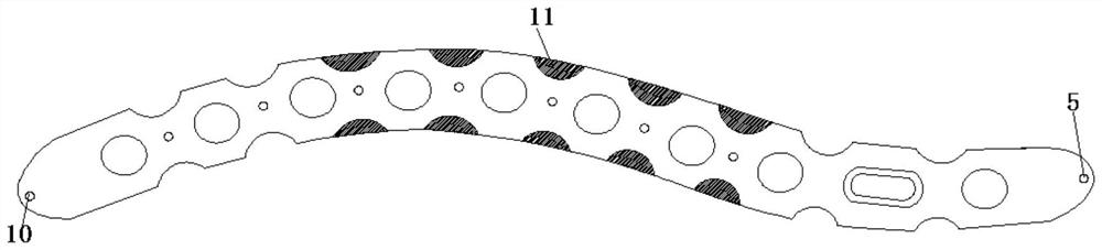 Clavicle middle section bone fracture plate