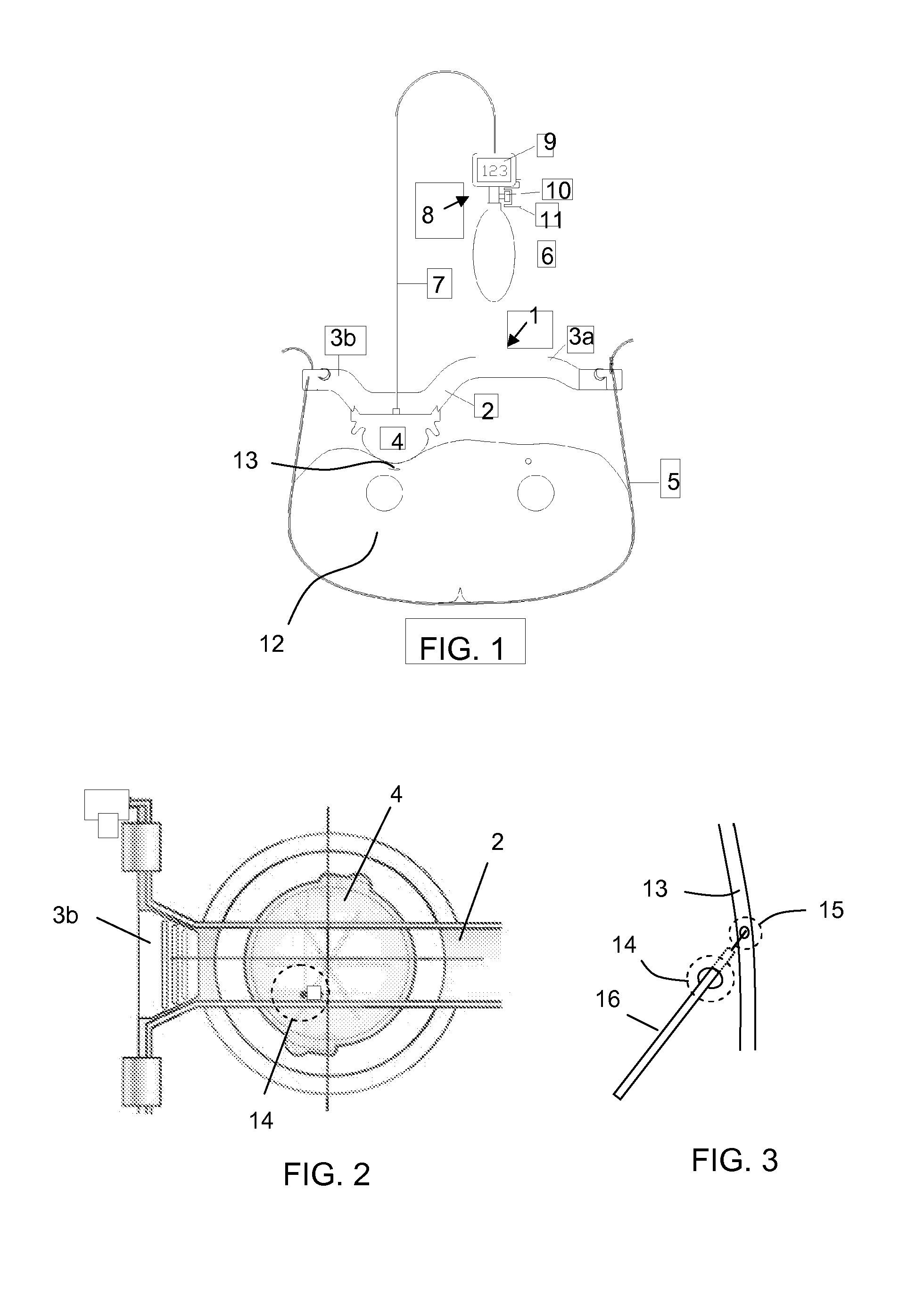 Compression system