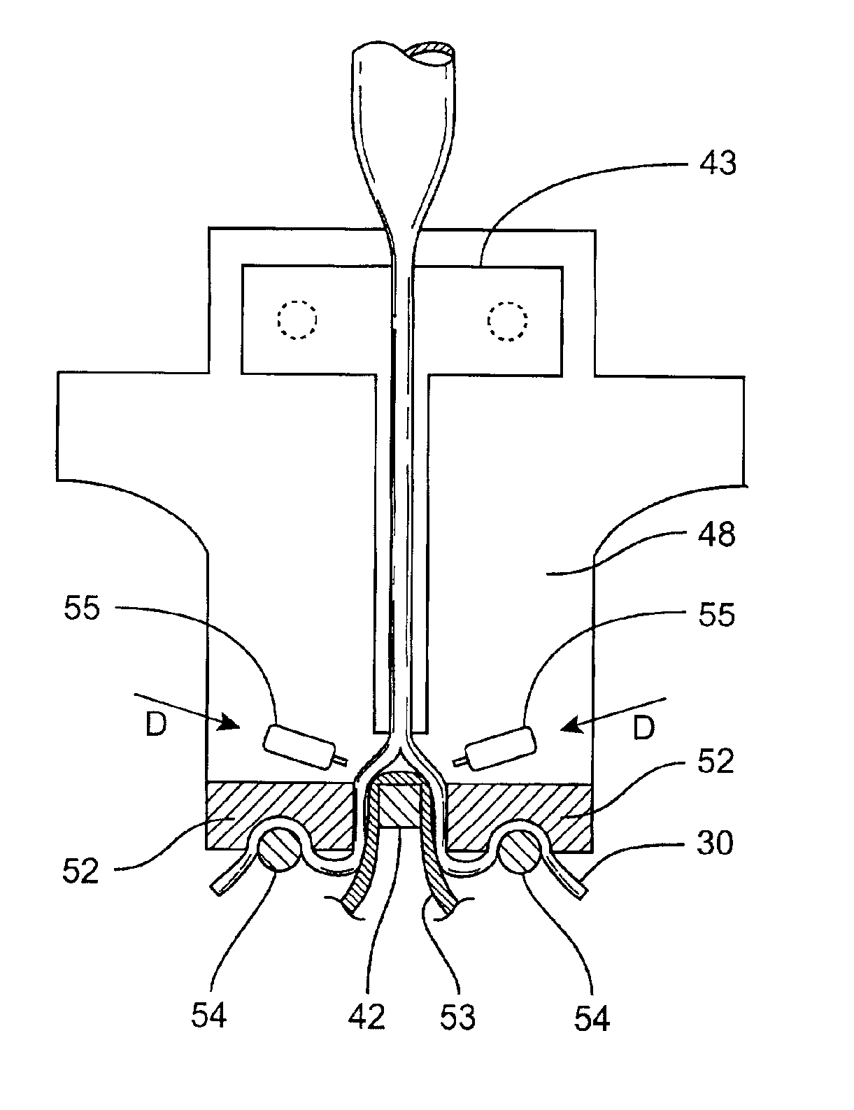 Method and system for performing closed-chest bypass
