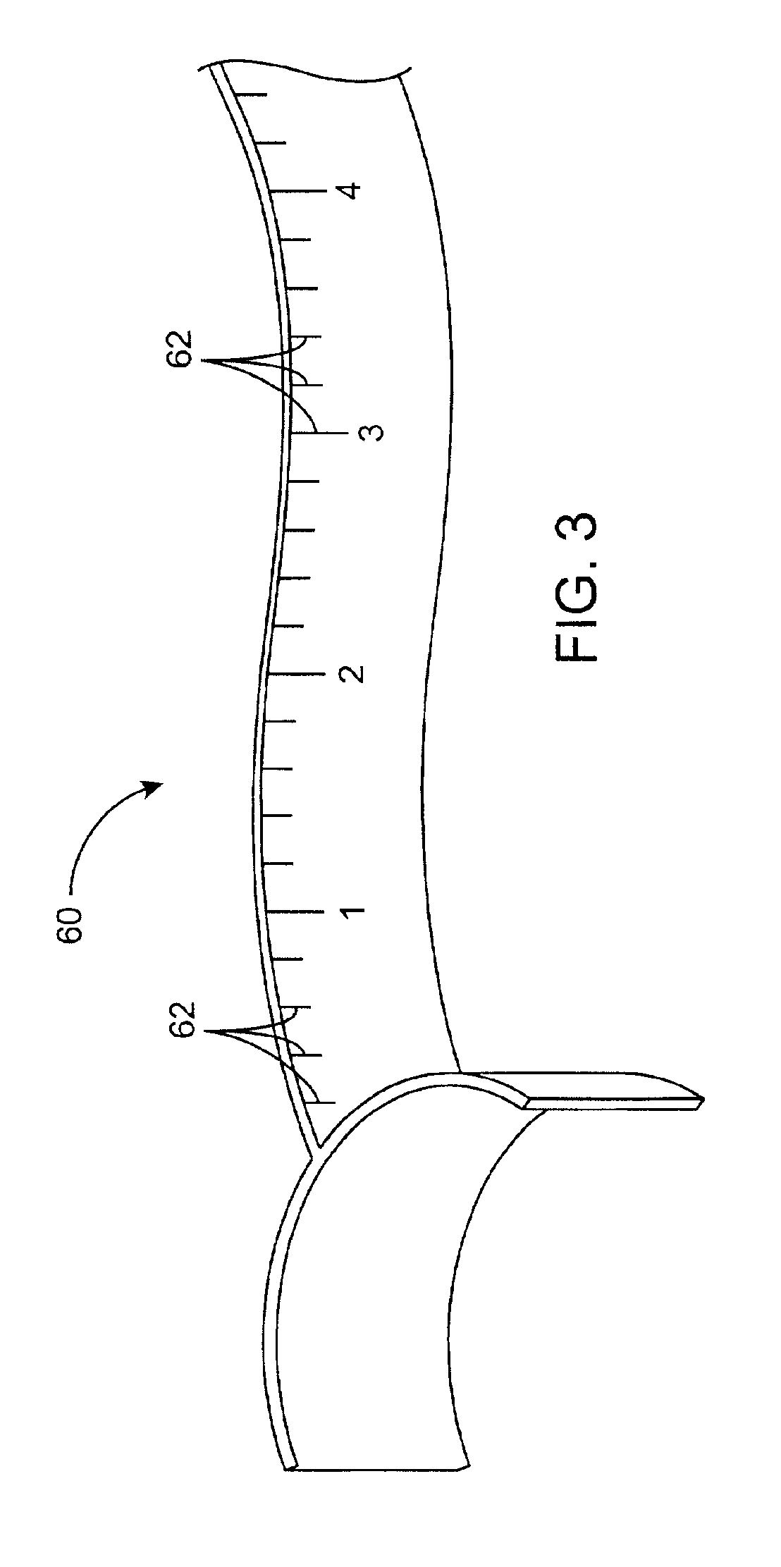 Method and system for performing closed-chest bypass