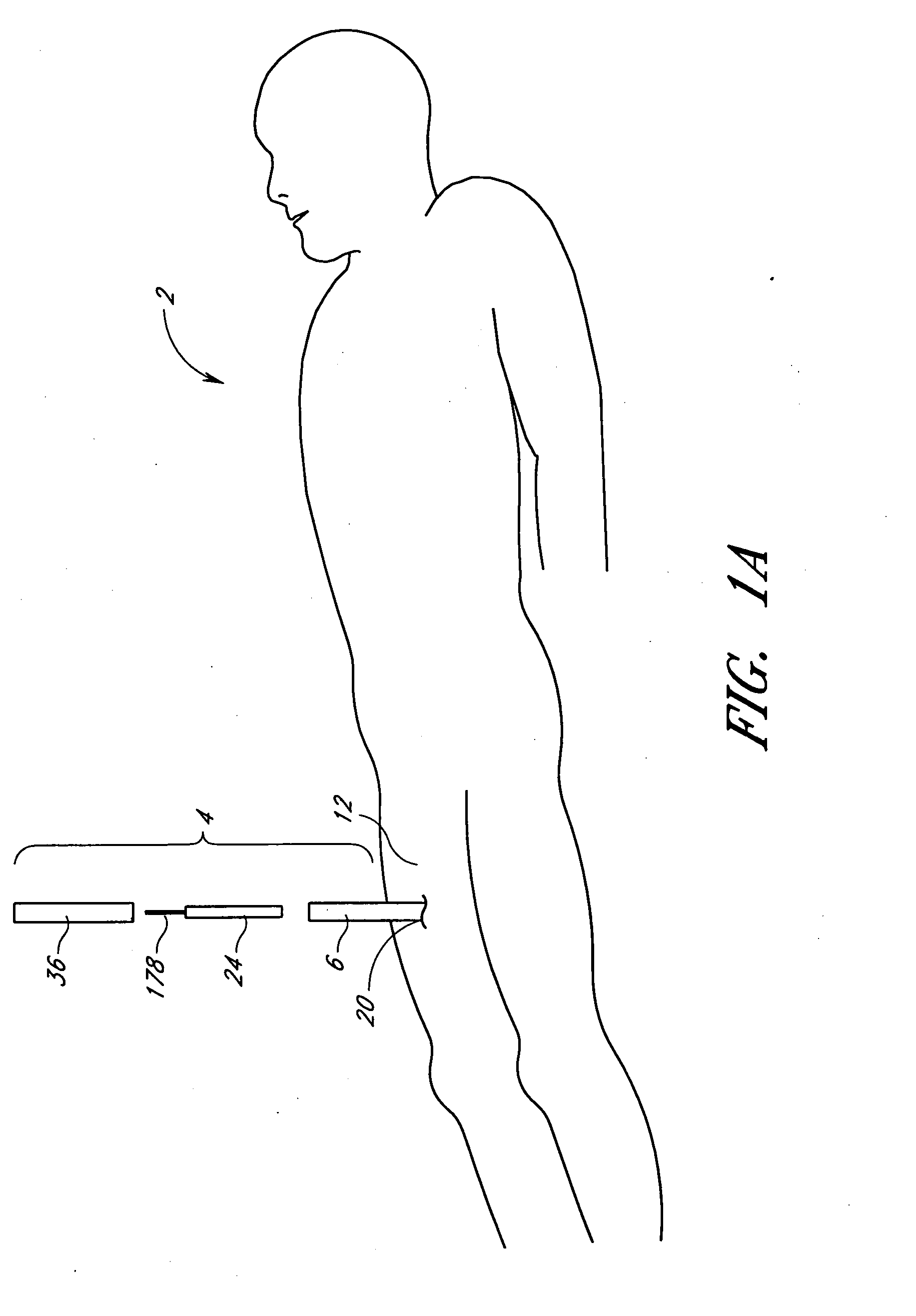 Suturing device and method