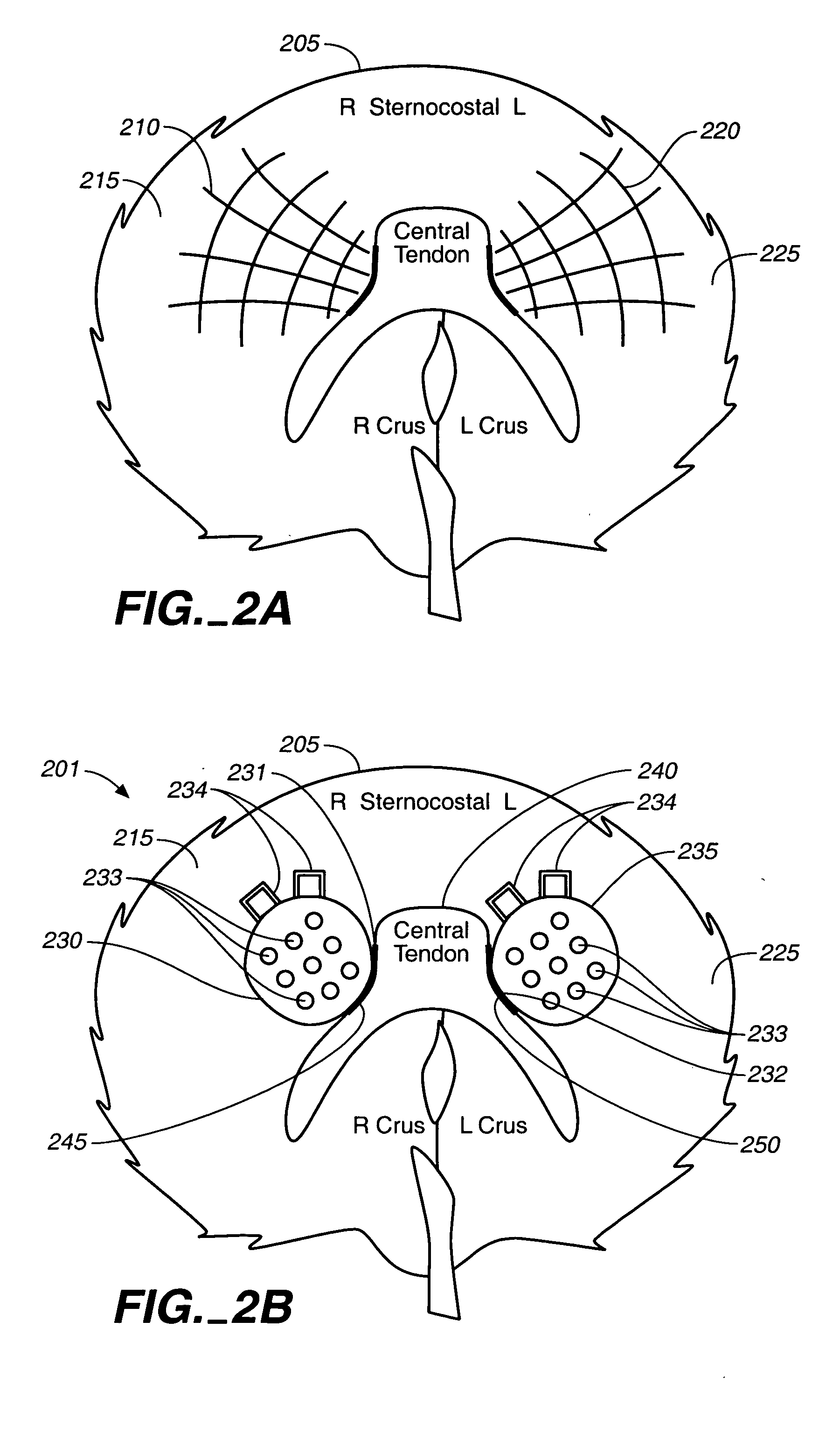 System and method for mapping diaphragm electrode sites