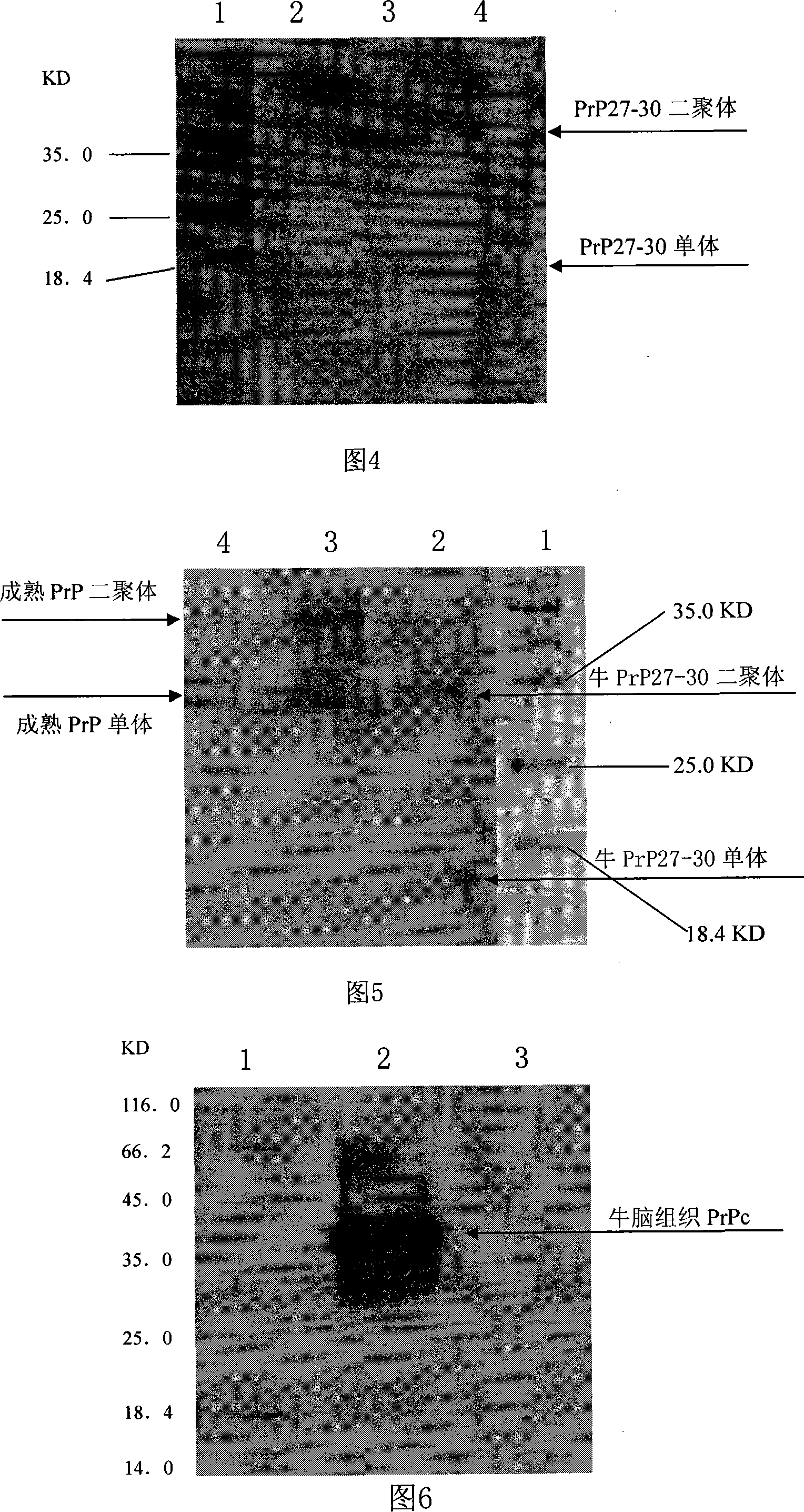 Monoclonal antibody for resisting bovine prion protein and application thereof