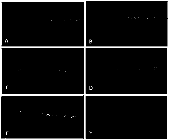 Application of composition of donkey-hide gelatin and novel donkey-hide gelatin to preparation of drug for preventing or treating diseases related to low leucocyte amount