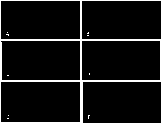 Application of composition of donkey-hide gelatin and novel donkey-hide gelatin to preparation of drug for preventing or treating diseases related to low leucocyte amount