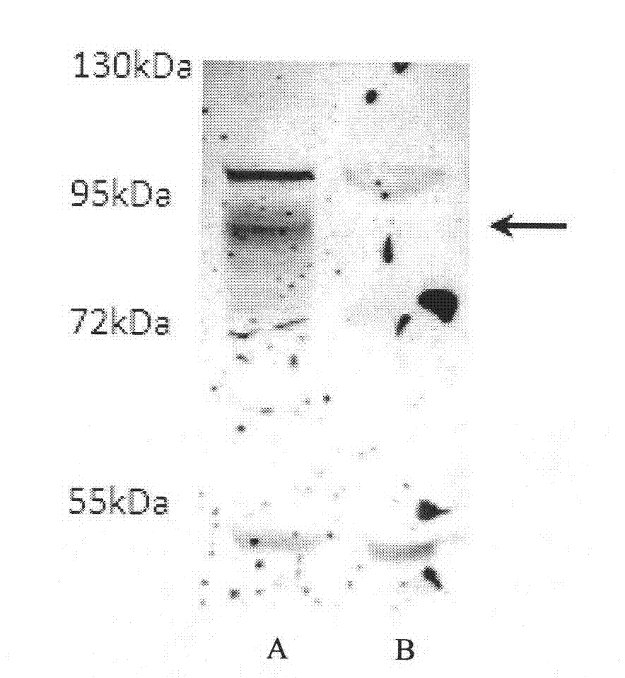 Monoclonal antibody of anti-human SIRPalpha, cell strain, preparation method and application thereof