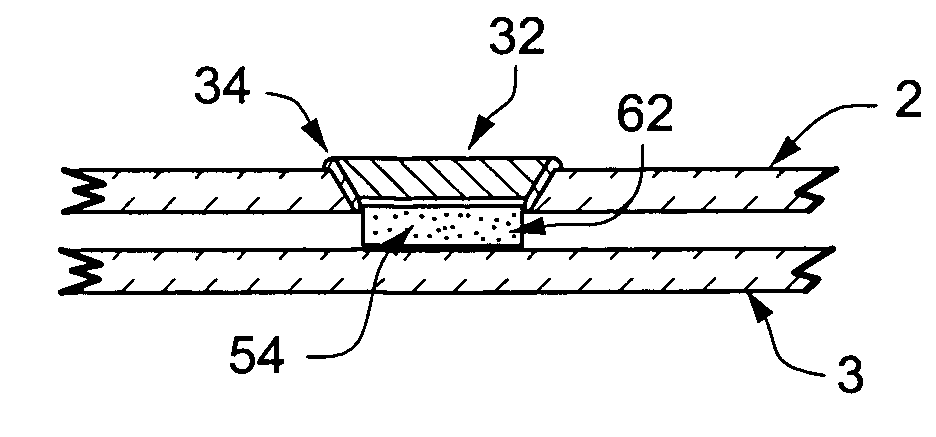 Vacuum insulating glass unit with large pump-out port, and/or method of making the same