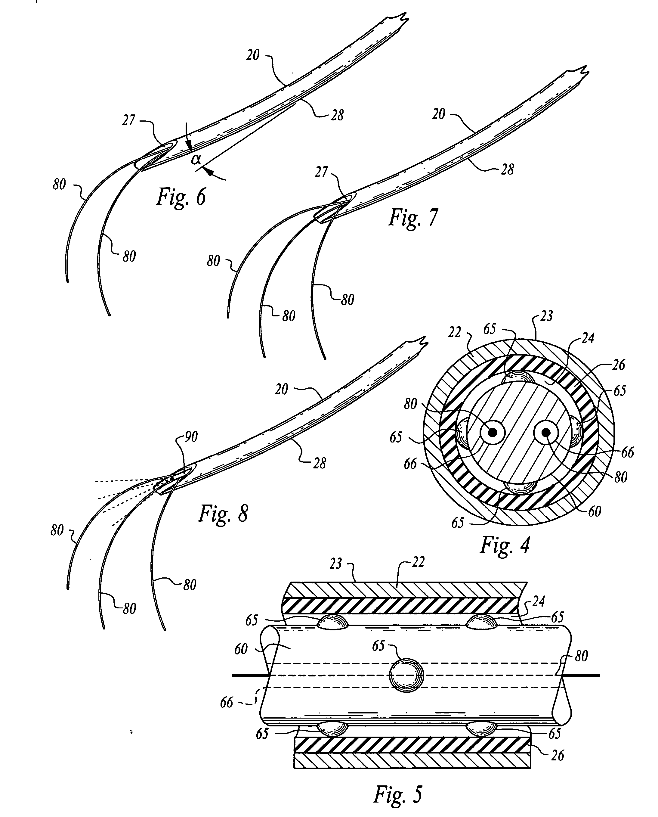 Navigable, multi-positional and variable tissue ablation apparatus and methods